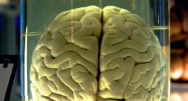 Brains missing from University of Texas collection likely destroyed