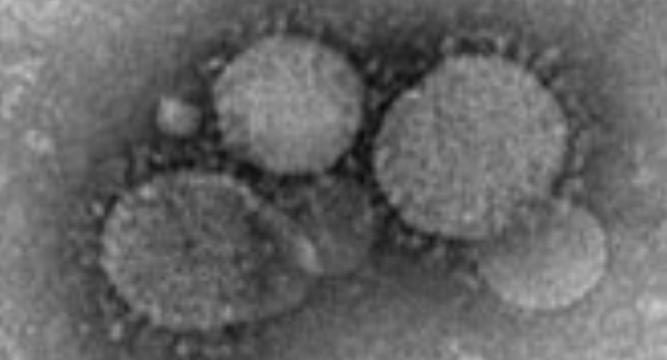 Deadly MERS virus linked to Egyptian tomb bat