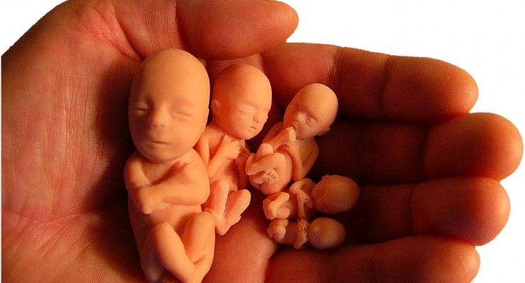 abortion pictures8