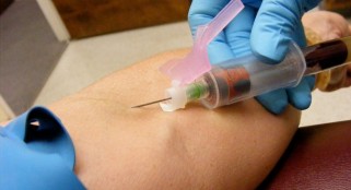 Blood test may predict HPV-related oral cancer, researchers say