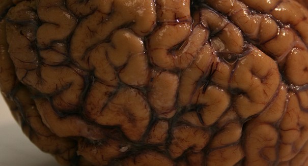 Zombies don’t get dementia. Eating human brains bolsters resistance