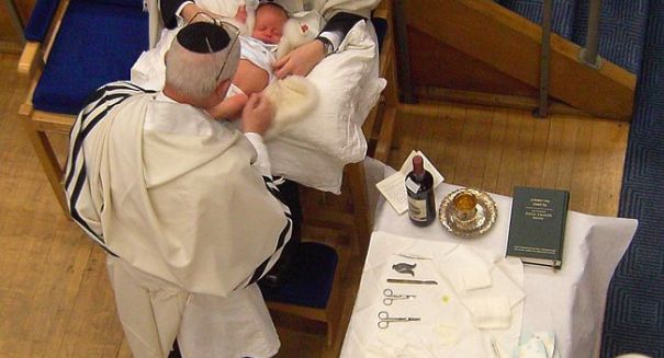 Herpes strikes two more infants after ritual oral blood sucking circumcision