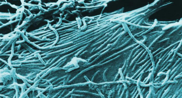 Breakthrough: Doctor develops groundbreaking new Ebola detection tool