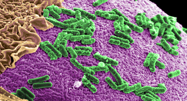Gut bacteria may be key to combating obesity