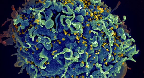 Stunning find: New HIV drug cuts infection by 86 percent in healthy gay men